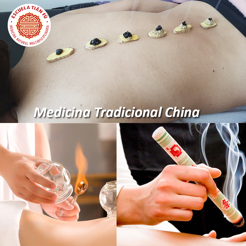 MEDICINA TRADICIONAL CHINA